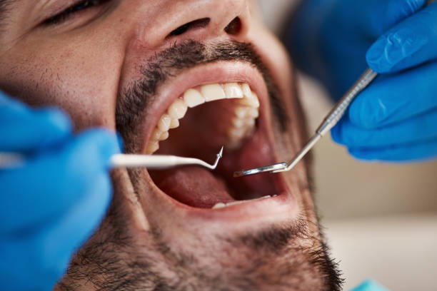 Oral Surgery in Union Springs, NY